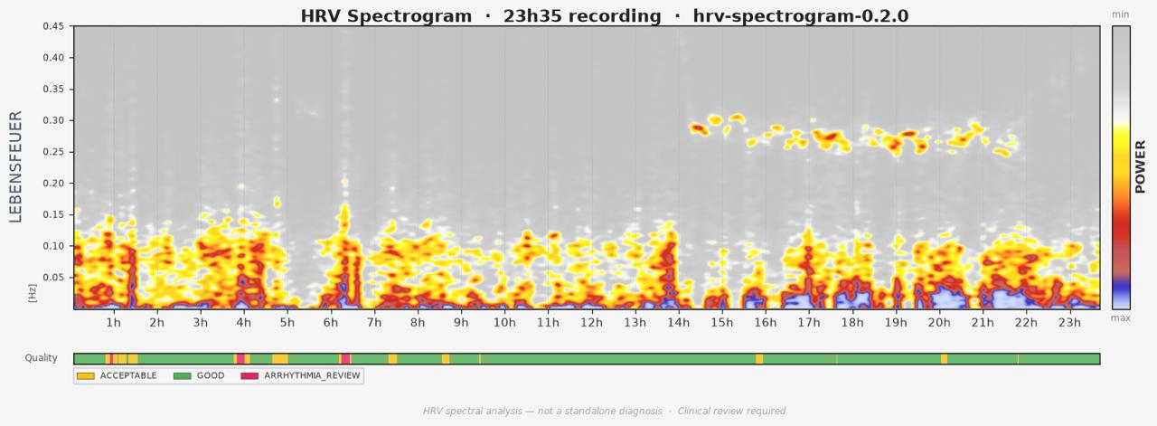 ECG ve HRV Analiz Platformu