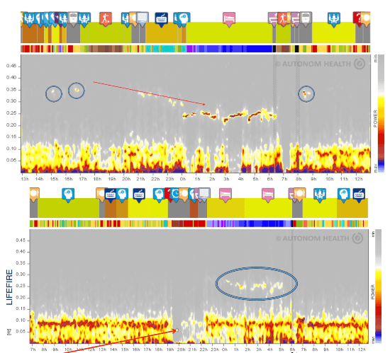 ECG ve HRV Analiz Platformu