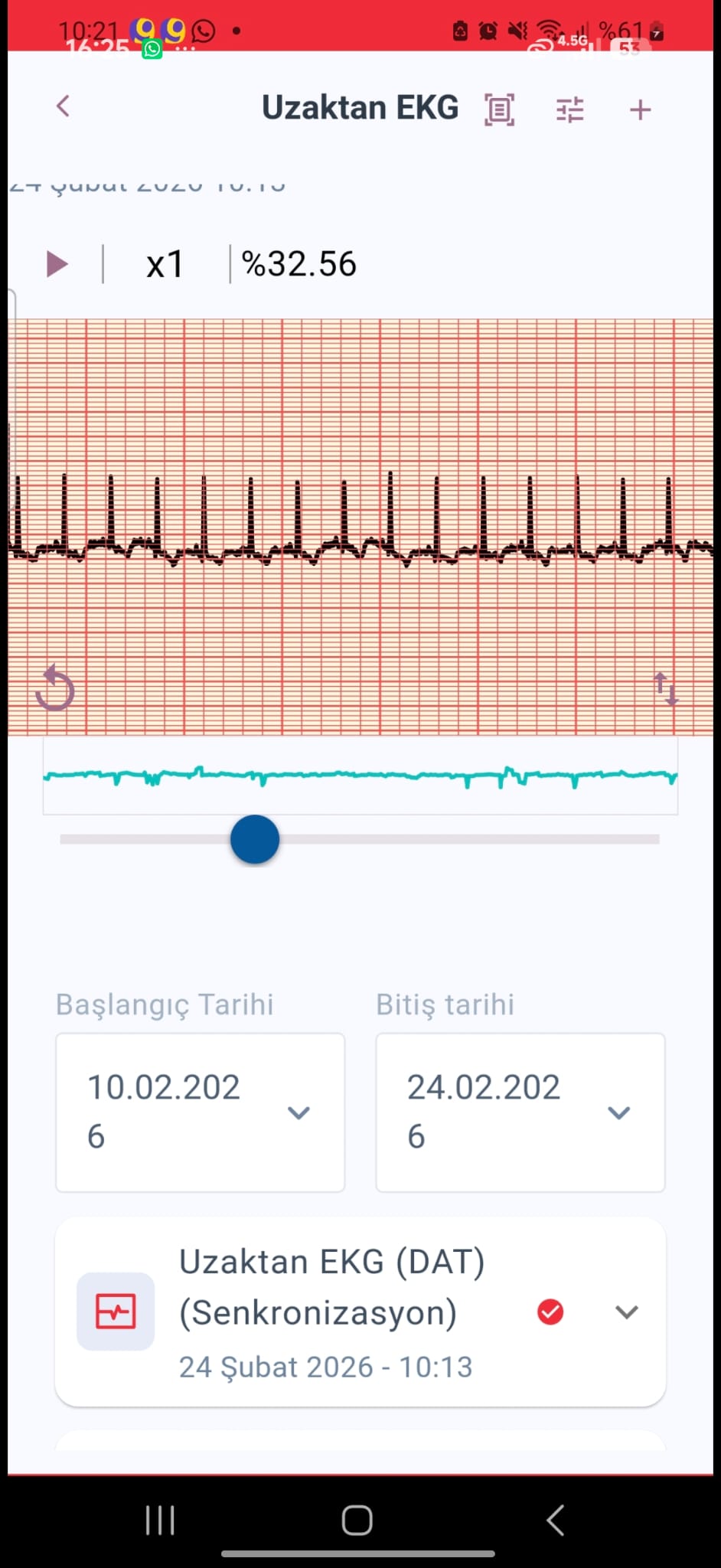 TURP Gerçek Zamanlı Vital Bulguların İzlenmesi