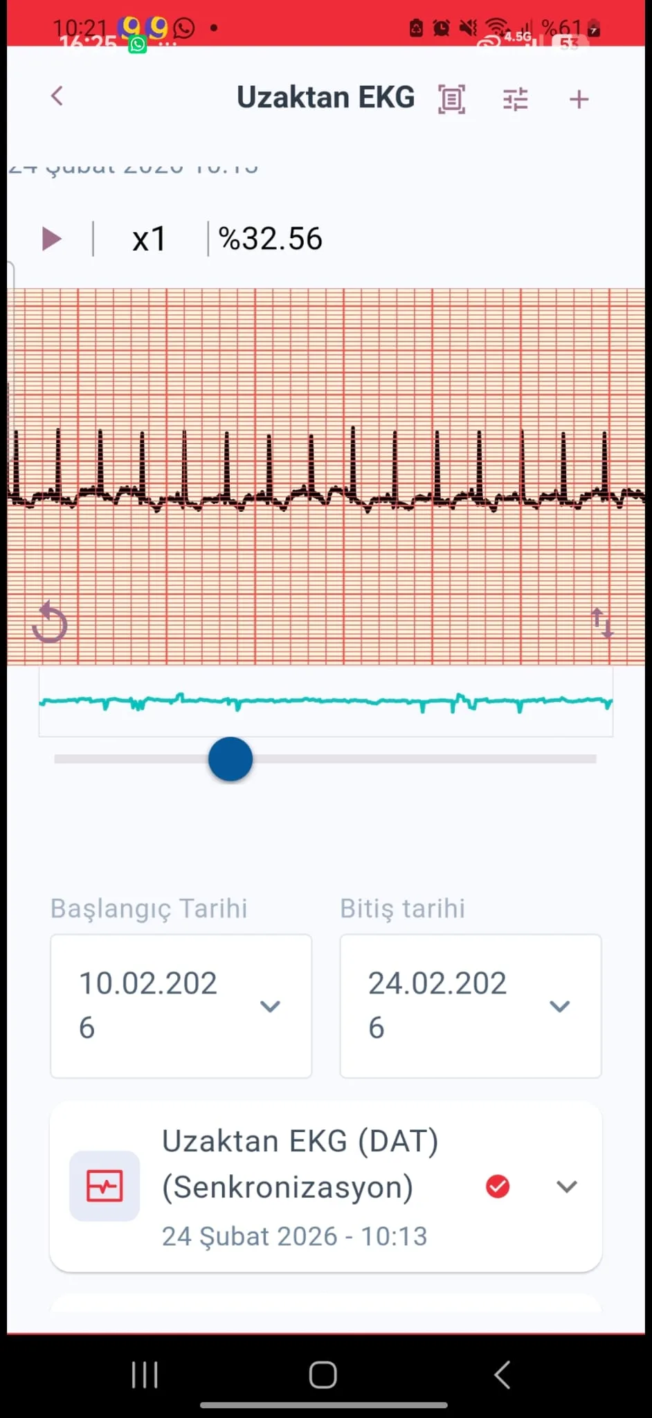 Patch EKG dijital takip ekranı